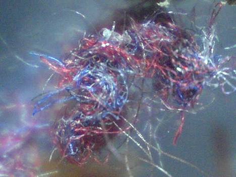 Morgellons Disease: The pink and blue fibers were analysed and were found to have the chemical profile of polythene! - www.viewzone.com